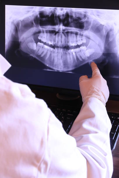 Best Emergency Wisdom Tooth Extraction in Plains, KS